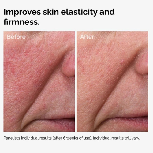 The Ordinary 100% Fermented Rose Hip Seed Oil – Regenerative & Brightening Facial Oil