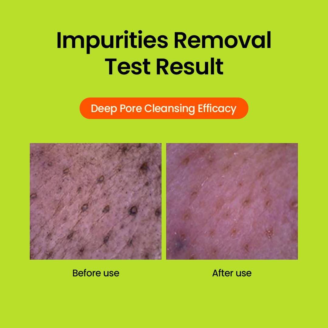 beplain Greenful pH-Balanced Cleansing Foam | Gentle Daily Face Wash