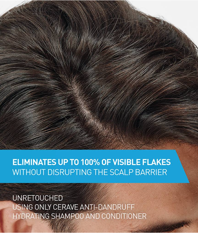 Anti-Dandruff Hydrating Shampoo – Fights Flakes & Itch While Nourishing Dry Scalp