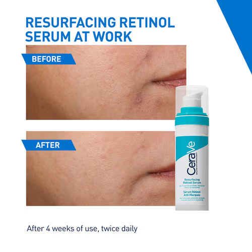 Resurfacing Retinol Serum – Smooth, Brighten & Renew