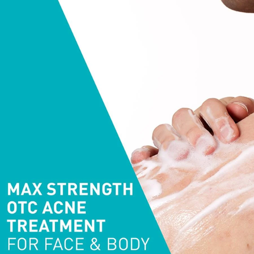 Acne Foaming Cream Wash – Deep-Cleansing Formula for Acne-Prone Skin |Cerave