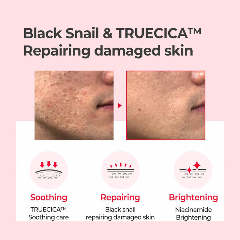 SOME BY MI Snail Truecica Miracle Repair Face Toner (150 ml)