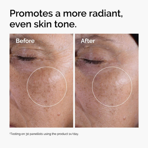 The Ordinary Glycolic Acid 7% Exfoliating Toner – Brightening & Smoothing Daily Peel