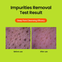 beplain Greenful pH-Balanced Cleansing Foam | Gentle Daily Face Wash