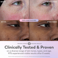 Olay Super Serum Mini