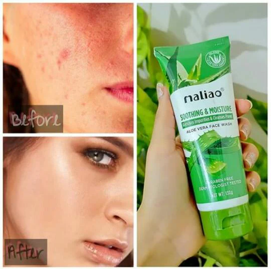 Maliao Deep Cleansing Face Wash – Clears Blackheads & Unclogs Pores