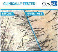 Anti-Dandruff Hydrating Shampoo – Fights Flakes & Itch While Nourishing Dry Scalp