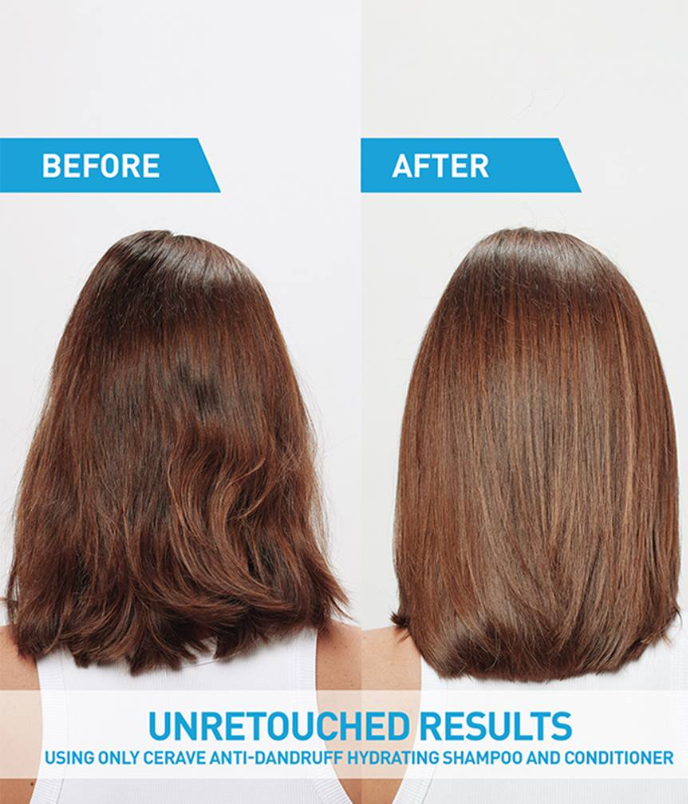 Anti-Dandruff Hydrating Shampoo – Fights Flakes & Itch While Nourishing Dry Scalp