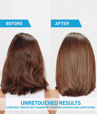 Anti-Dandruff Hydrating Shampoo – Fights Flakes & Itch While Nourishing Dry Scalp