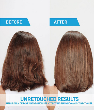 Anti-Dandruff Hydrating Conditioner – Soothes Scalp & Restores Moisture Without Buildup