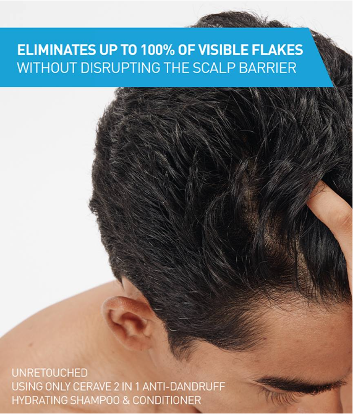 2-in-1 Anti-Dandruff Hydrating Shampoo & Conditioner – Cleanses, Fights Flakes & Moisturizes