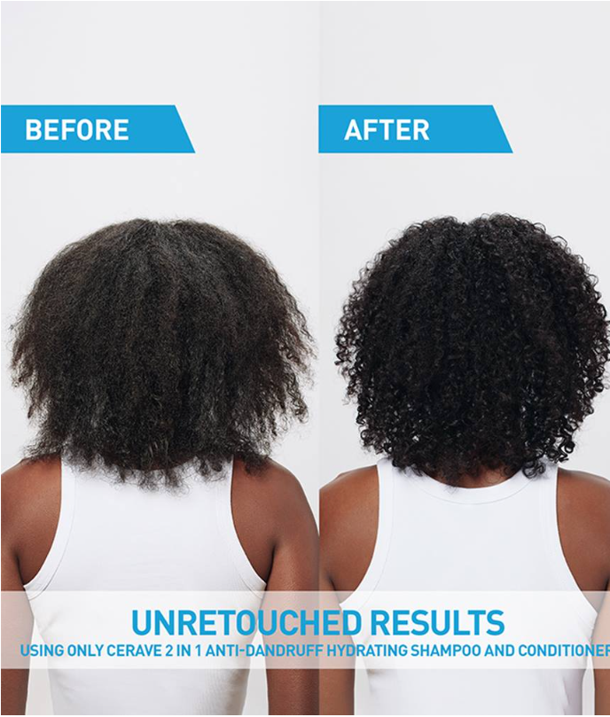 2-in-1 Anti-Dandruff Hydrating Shampoo & Conditioner – Cleanses, Fights Flakes & Moisturizes