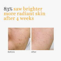 O3+ Vitamin-C Serum Glow for Dark Spots and Pigmentation (30ml)