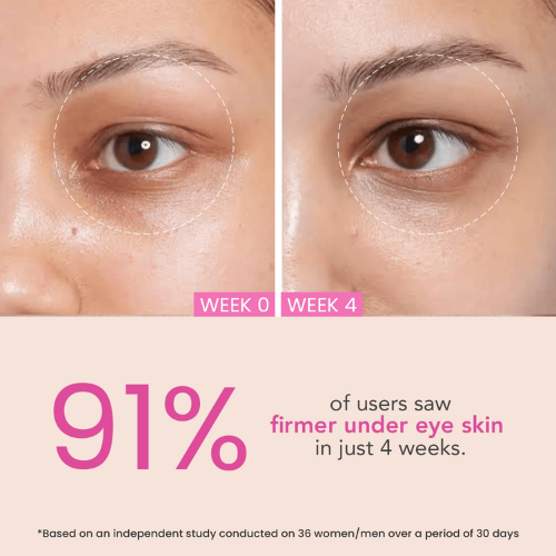 O3+ Eye Circle Cream - Brightening & Whitening for Dark Circles (15g)
