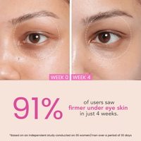 O3+ Eye Circle Cream - Brightening & Whitening for Dark Circles (15g)