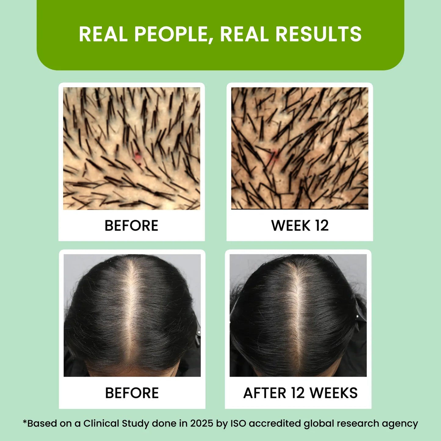 Alps Goodness Rosemary Water (100 ml) | Nourishing Hair & Scalp Mist | Strengthens Roots, Reduces Hair Fall & Promotes Growth