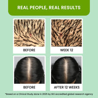 Alps Goodness Rosemary Water (100 ml) | Nourishing Hair & Scalp Mist | Strengthens Roots, Reduces Hair Fall & Promotes Growth