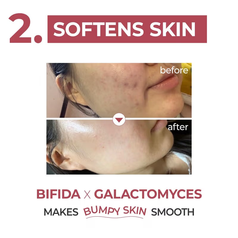 Numbuzin No.3 Skin Softening & Pore-Tightening Serum (50ml) | Bifida + Galactomyces for Elasticity