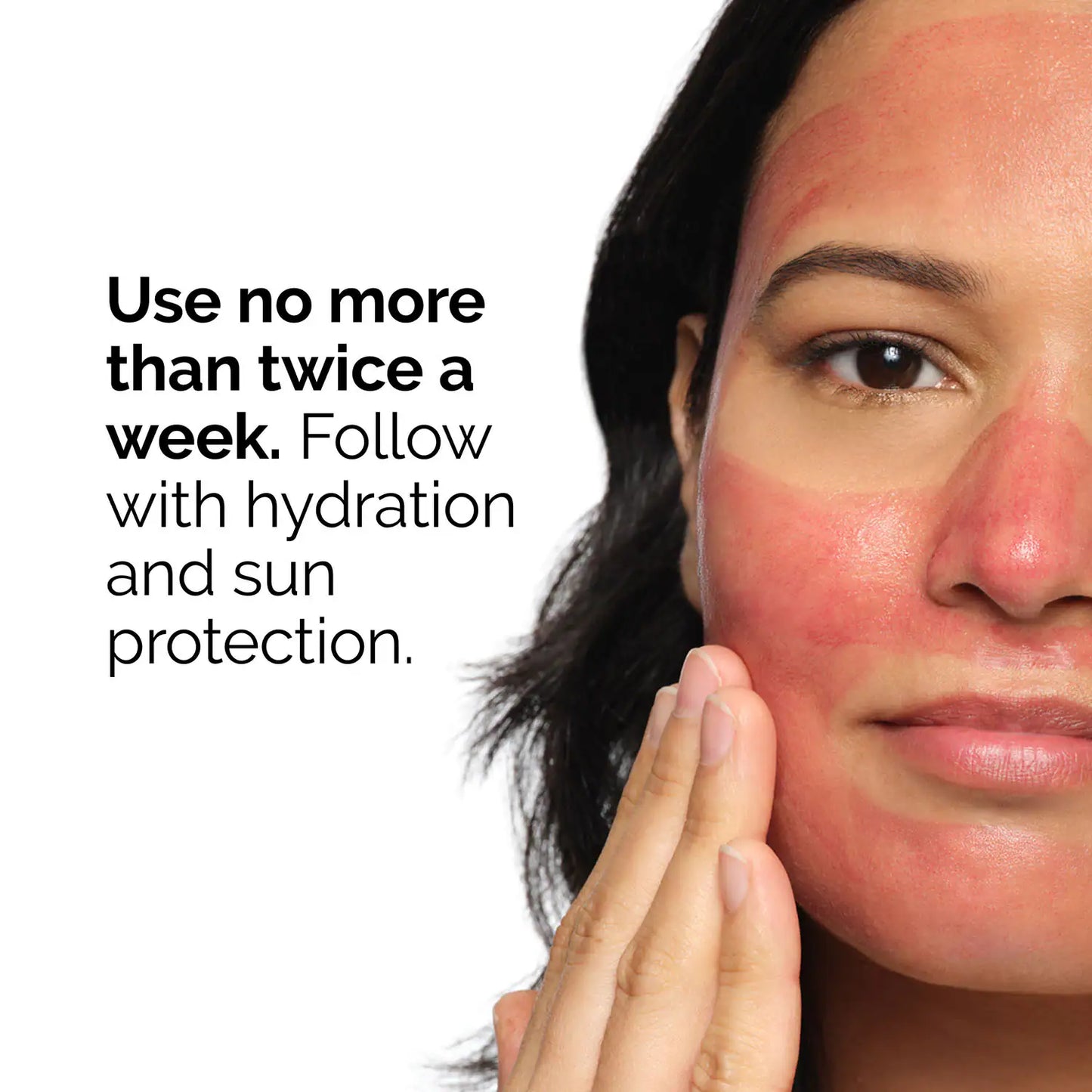 The Ordinary AHA 30% + BHA 2% Peeling Solution (30 ml)