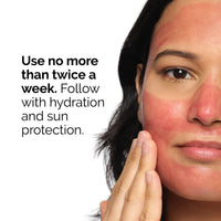 The Ordinary AHA 30% + BHA 2% Peeling Solution (30 ml)